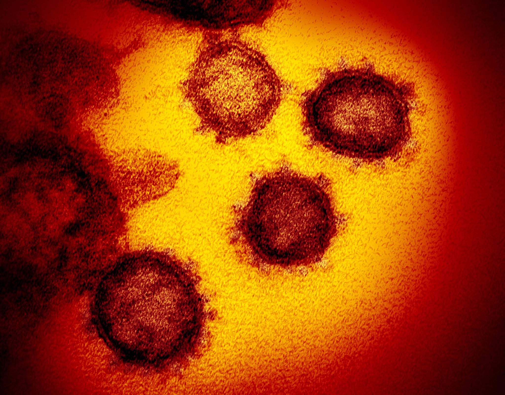 Image in @MarioNawfal's post: 🚨JUST IN: UK CONFIRMS NEW VIRUS
The UK has confirmed its first human case of a new swine flu strai…