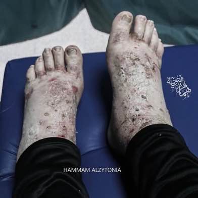 Image in @xIsraelExposedx's post: Wael Juma, released yesterday, was tortured for months, and reports seeing dozens of others torture…
