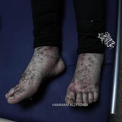 Image in @xIsraelExposedx's post: Wael Juma, released yesterday, was tortured for months, and reports seeing dozens of others torture…