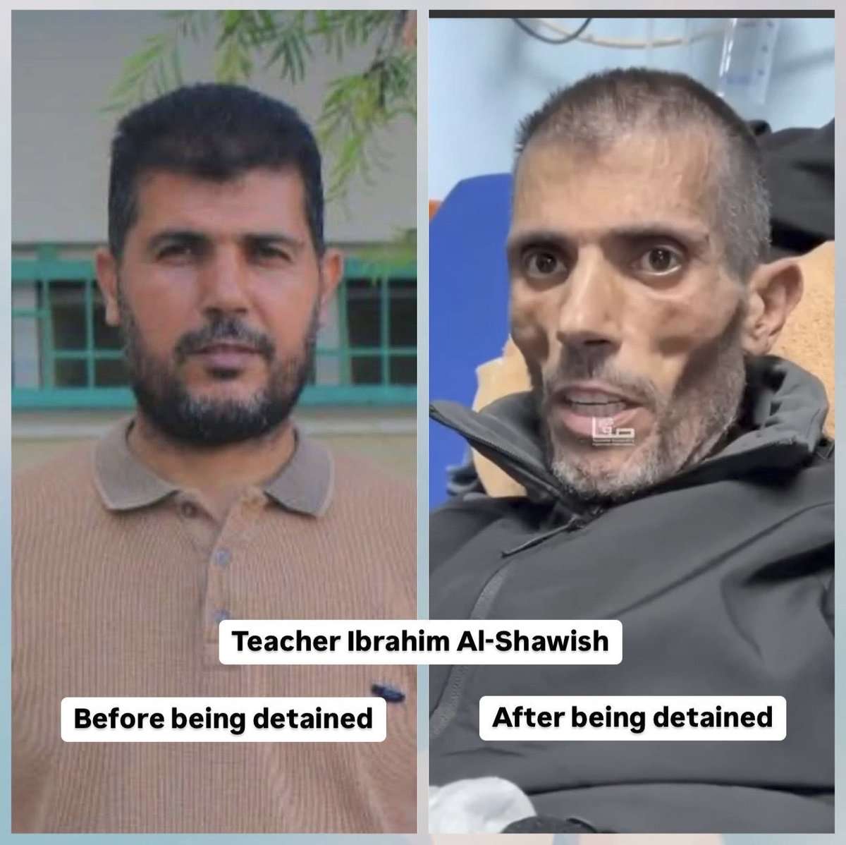 Image in @xIsraelExposedx's post: A teacher, Ibrahim Al shawish was tortured and starved almost to death in Israeli detainment.
He …