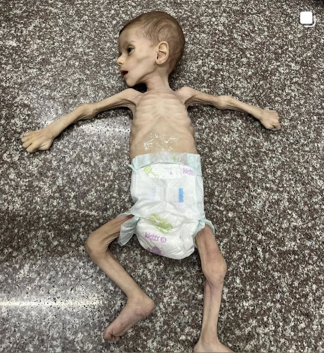 Image in @xIsraelExposedx's post: The forced starvation of 1 million children on live stream, during an ongoing genocide, will be a d…