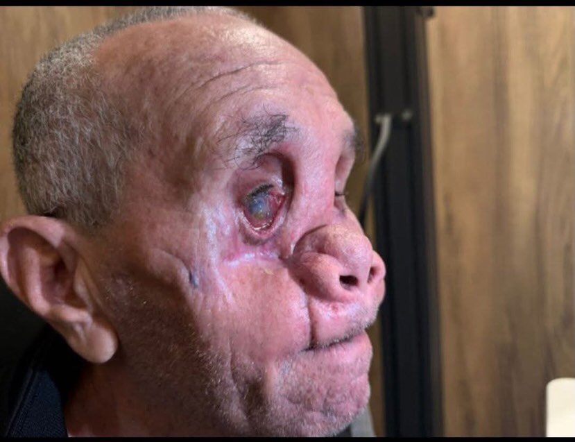 Image in @xIsraelExposedx's post: An Egyptian ophthalmologist shared these images of a man from Gaza who was recently evacuated after…