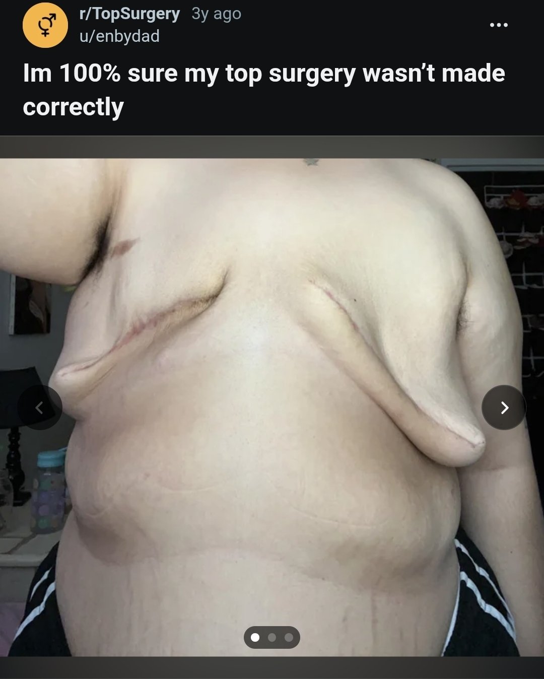 Image in @IfindRetards's post: Yeah, we can all agree there is nothing normal about this.
Just browsed this sub of reddit and c…