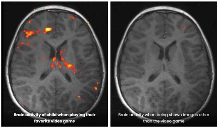 Image in @MarioNawfal's post: 🇸🇪 Are screens and AI making our kids dumber?
Sweden seems to think so, and it's not the only cou…