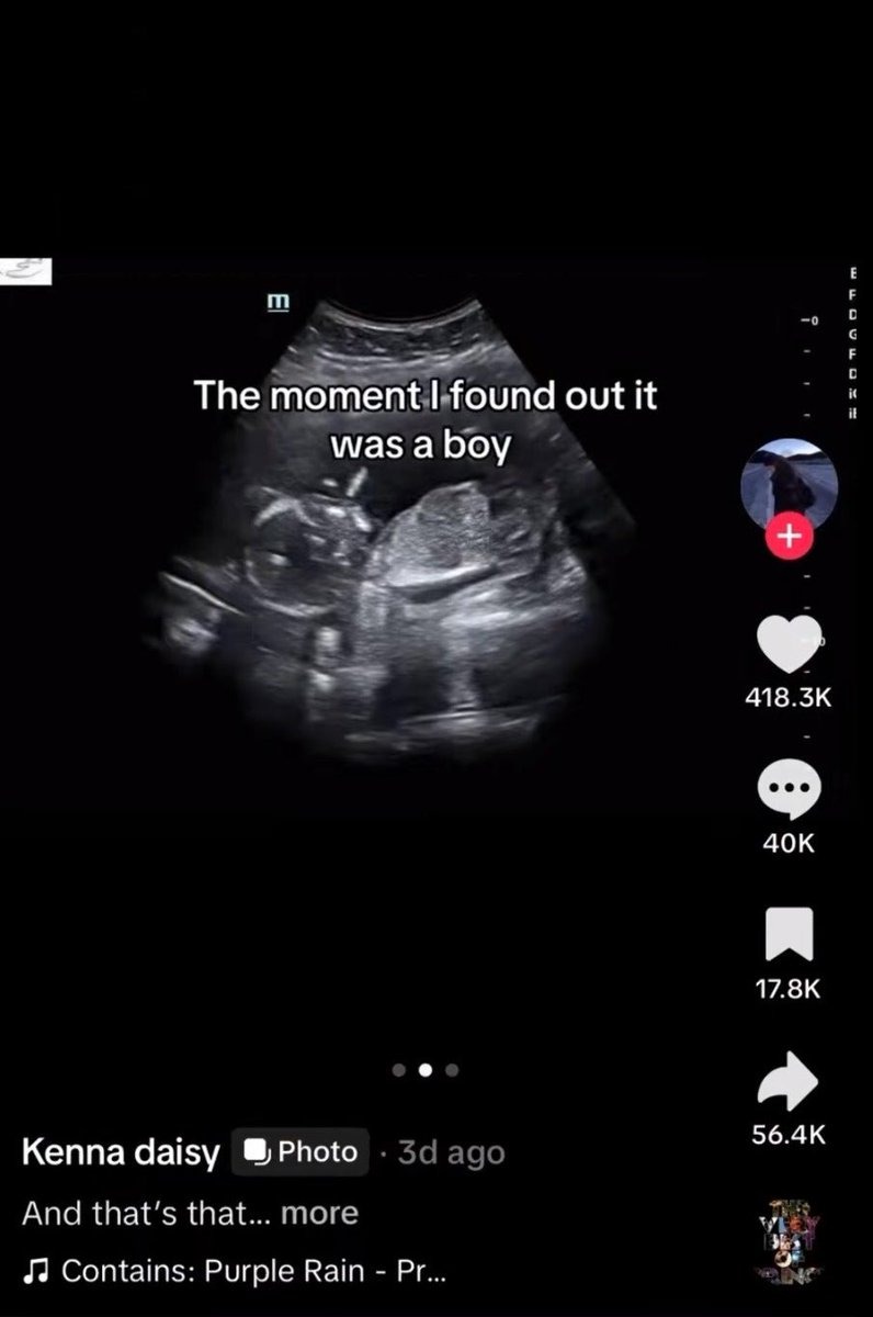 Image in @MarioNawfal's post: She gleefully claimed she scheduled an ABORTION after finding out it's a BOY and got over 400,000 L…